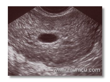 ultrason resimleri dr alper mumcu
