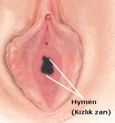 hymen_001